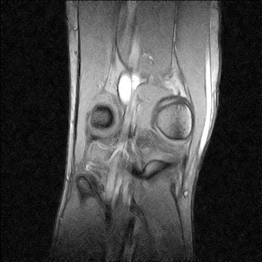 MRI - right knee - top down 2 - animated